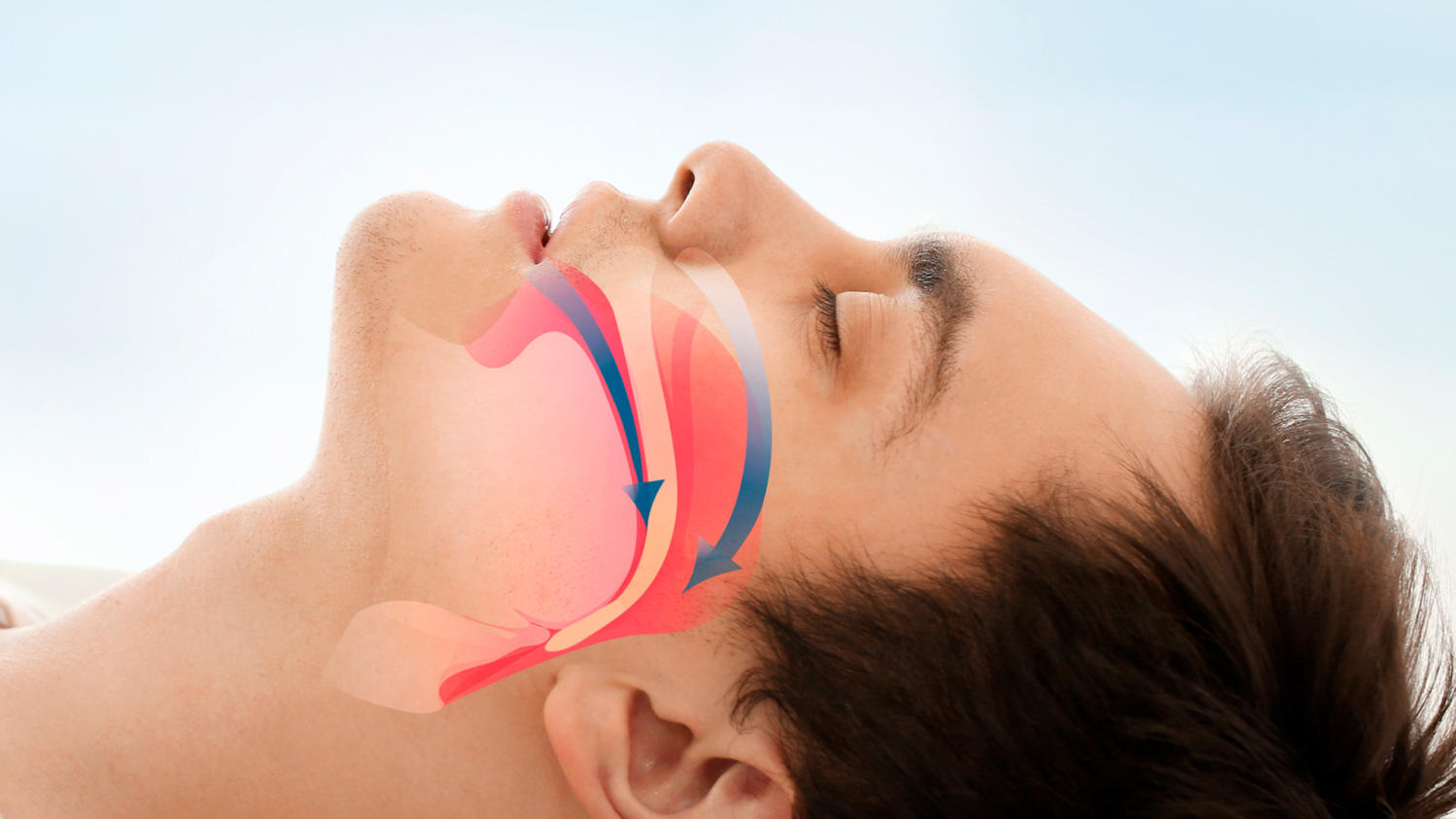 Apnee notturne Medical Sonno